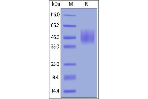 SDS-PAGE (SDS) image for CD226 (CD226) (AA 19-252) (Active) protein (His tag) (ABIN6388274)