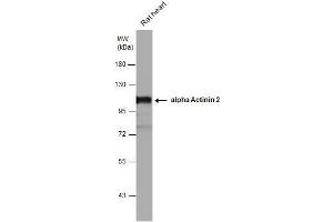 WB Image alpha Actinin 2 antibody detects alpha Actinin 2 protein by western blot analysis. (ACTN2 抗体)