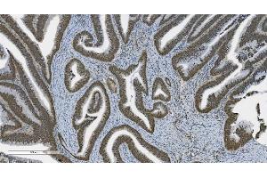 IHC analysis of PARP using anti-PARP antibody (ABIN7602278). (PARP1 抗体  (AA 670-858))