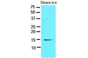 Western Blotting (WB) image for anti-Cellular Retinoic Acid Binding Protein 1 (CRABP1) (AA 1-137), (N-Term) antibody (ABIN400870) (CRABP1 抗体  (N-Term))