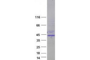 Western Blotting (WB) image for Aryl Hydrocarbon Receptor Nuclear Translocator (ARNT) (Transcript Variant 2) protein (Myc-DYKDDDDK Tag) (ABIN2716392)