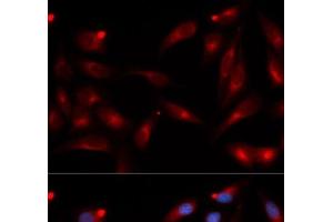 Immunofluorescence analysis of U2OS cells using ADAM9 Polyclonal Antibody (ADAM9 抗体)