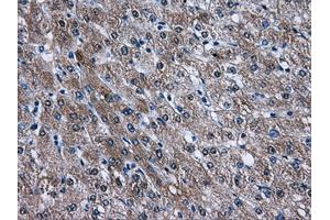 Immunohistochemical staining of paraffin-embedded liver tissue using anti-AKT2mouse monoclonal antibody. (AKT2 抗体)