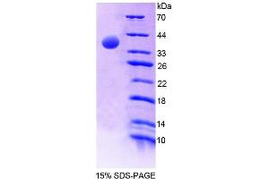 SDS-PAGE analysis of Human EPB41 Protein. (EPB41 蛋白)