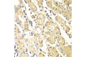 Immunohistochemistry of paraffin-embedded human gastric using PDCD2L antibody (ABIN4904708) at dilution of 1:100 (40x lens). (PDCD2L 抗体)