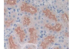 DAB staining on IHC-P; Samples: Rat Kidney Tissue (ICOS 抗体  (AA 39-133))