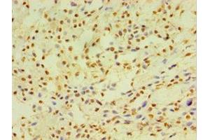Immunohistochemistry (IHC) image for anti-Cytochrome P450, Family 2, Subfamily J, Polypeptide 2 (CYP2J2) (AA 328-502) antibody (ABIN7149254)