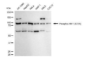Western blotting analysis using phospho-IRE1 (S724) antibody (ABIN7798443).