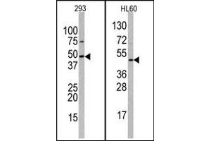 Image no. 1 for anti-Suppressor of Variegation 3-9 Homolog 2 (Drosophila) (SUV39H2) (C-Term) antibody (ABIN356791)