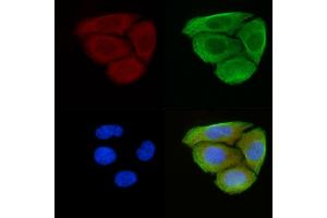 anti-Peroxisomal Biogenesis Factor 10 (PEX10) (Internal Region) antibody