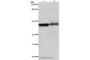 Western blot analysis of Hela and A549 cell, using ADRB2 Polyclonal Antibody at dilution of 1:600 (beta 2 Adrenergic Receptor 抗体)