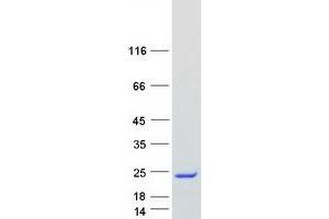 Validation with Western Blot