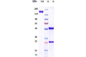Anti-Clusterin Reference Antibody (AB-16B5) on SDS-PAGE under reducing (R) condition.