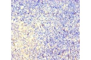 Immunohistochemistry of paraffin-embedded human pancreatic tissue using ABIN7148826 at dilution of 1:100 (CNGA4 抗体  (AA 1-575))