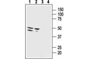 Western blot analysis of human malignant melanoma cell line Malme-3M (lanes 1 and 3) and human normal skin fibroblast cell line Malme-3 (lanes 2 and 4): - 1,2. (Bombesin Receptor 3 抗体  (2nd Extracellular Loop))