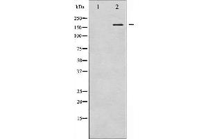 Western blot analysis of NMDAR2B phosphorylation expression in UV treated Jurkat whole cell lysates,The lane on the left is treated with the antigen-specific peptide. (GRIN2B 抗体  (pTyr1474))