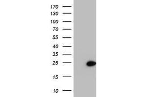 HEK293T cells were transfected with the pCMV6-ENTRY control (Left lane) or pCMV6-ENTRY PSMB9 (Right lane) cDNA for 48 hrs and lysed. (PSMB9 抗体  (AA 21-219))