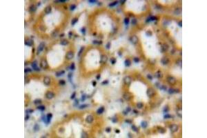 Used in DAB staining on fromalin fixed paraffin-embedded Liver tissue (C4A 抗体  (AA 680-756))