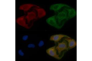 NIPSNAP1 Mouse Monoclonal Antibody staining Hela cells by IF/ICC. (NIPSNAP1 抗体)