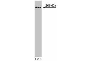 Western blot analysis of GBF1 on a HeLa cell lysate (Human cervical epitheloid carcinoma, ATCC CCL-2. (GBF1 抗体  (AA 1266-1379))