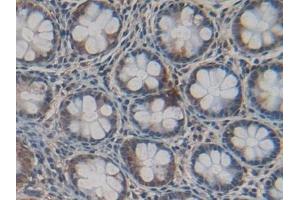 Detection of Cys-C in Human Intestine Tissue using Polyclonal Antibody to Cystatin C (Cys-C) (Cystathionine-gamma-Synthase Precursor (CYS) (AA 27-146) 抗体)