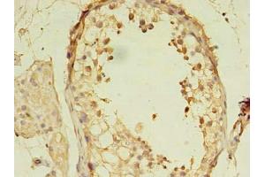 Immunohistochemistry of paraffin-embedded human testis tissue using ABIN7160198 at dilution of 1:100 (MORC2 抗体  (AA 2-300))
