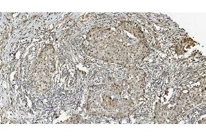 IHC analysis of MCM5 using anti-MCM5 antibody (ABIN7600583).