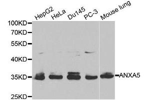 Western blot analysis of extracts of various cell lines, using ANXA5 antibody. (Annexin V 抗体  (AA 1-320))