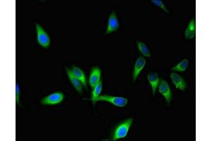 Immunofluorescent analysis of Hela cells using ABIN7170721 at dilution of 1:100 and Alexa Fluor 488-congugated AffiniPure Goat Anti-Rabbit IgG(H+L) (Stathmin 1 抗体  (AA 13-78))