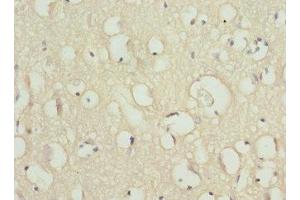 Immunohistochemistry of paraffin-embedded human brain tissue using ABIN7169937 at dilution of 1:100 (SCN2B 抗体  (AA 30-160))