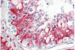 Human Testis: Formalin-Fixed, Paraffin-Embedded (FFPE) (LHCGR 抗体  (AA 622-699))