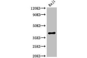 Western Blot Positive WB detected in: Raji whole cell lysate All lanes: HMBS antibody at 3 μg/mL Secondary Goat polyclonal to rabbit IgG at 1/50000 dilution Predicted band size: 40, 38, 35, 34 kDa Observed band size: 40 kDa (HMBS 抗体  (AA 283-330))
