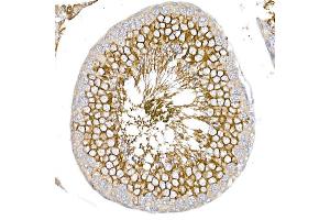 Immunohistochemistry of paraffin-embedded rat testis using GLUT3/SLC2 Rabbit pAb (ABIN6134111, ABIN6147961, ABIN6147962 and ABIN6224173) at dilution of 1:50 (40x lens). (SLC2A3 抗体  (AA 150-250))