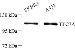 Western blot analysis of TTC7A (ABIN7075875) at dilution of 1: 1000 (TTC7A 抗体)