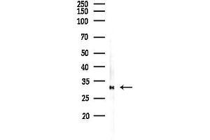 anti-Phosphomannomutase 2 (PMM2) (C-Term) antibody