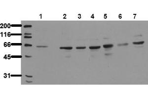 Western Blotting (WB) image for anti-P21-Activated Kinase 4 (PAK4) antibody (ABIN492621) (PAK4 抗体)