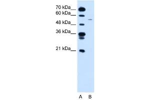 Western Blotting (WB) image for anti-Cyclin B1 (CCNB1) (C-Term) antibody (ABIN2779290)