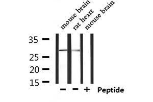 Western Blotting (WB) image for anti-Fc Fragment of IgG, Low Affinity IIIa, Receptor (CD16a) (FCGR3A) (C-Term) antibody (ABIN6261703)