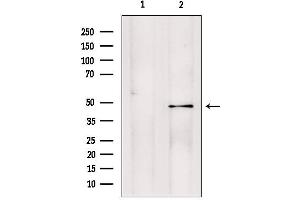Western blot analysis of extracts from ratbrain, using PMPCB antibody. (PMPCB 抗体  (Internal Region))