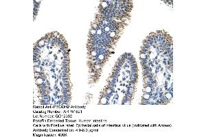 Rabbit Anti-PRODH2 Antibody  Paraffin Embedded Tissue: Human Intestine Cellular Data: Epithelial cells of intestinal villas Antibody Concentration: 4. (PRODH2 抗体  (C-Term))
