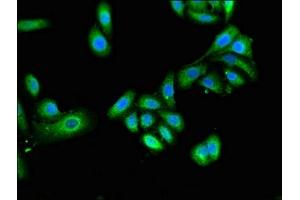 Immunofluorescent analysis of HepG2 cells using ABIN7151278 at dilution of 1:100 and Alexa Fluor 488-congugated AffiniPure Goat Anti-Rabbit IgG(H+L) (TRIM4 抗体  (AA 1-118))