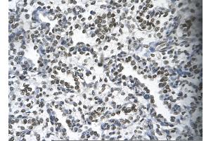 Immunohistochemistry (IHC) image for anti-Homeobox B9 (HOXB9) (N-Term) antibody (ABIN2779768)