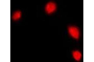 Immunofluorescent analysis of IFI16 staining in U2OS cells. (IFI16 抗体)