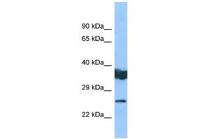 WB Suggested Anti-LYPLAL1 Antibody Titration: 1. (LYPLAL1 抗体  (Middle Region))
