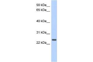 WB Suggested Anti-CCDC70 Antibody Titration: 0. (CCDC70 抗体  (Middle Region))