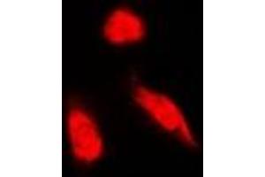 Immunofluorescent analysis of NCK1 staining in Hela cells. (NCK1 抗体)