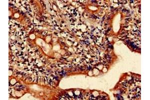 Immunohistochemistry of paraffin-embedded human small intestine tissue using ABIN7155233 at dilution of 1:100 (HRH1 抗体  (AA 211-416))