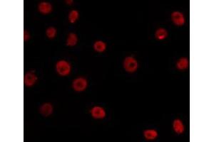 ABIN6266532 staining HepG2 by IF/ICC. (E2F6 抗体  (Internal Region))
