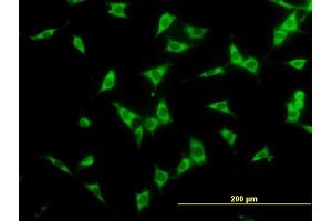 Immunofluorescence of monoclonal antibody to NCOA4 on NIH/3T3 cell. (NCOA4 抗体  (AA 505-614))