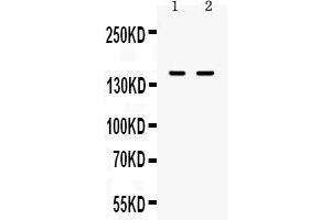 Western blot analysis of CD11a using anti-CD11a antibody . (ITGAL 抗体  (AA 161-349))
